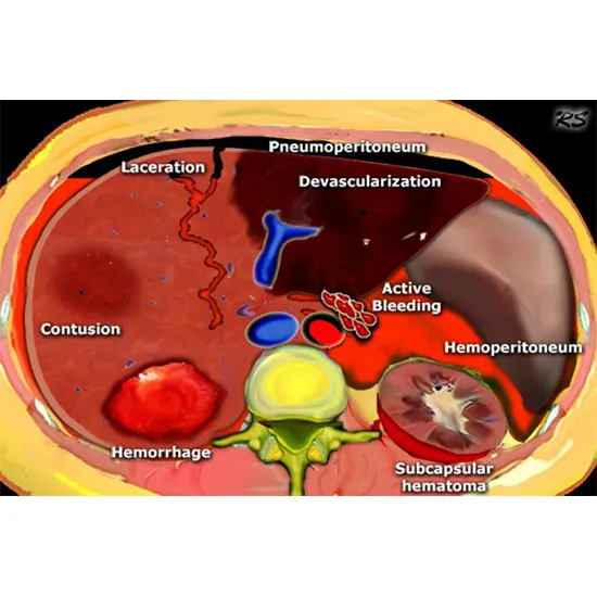 What Is The Role Of CT Scan In Trauma?